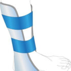 Prometheus Omni Splint